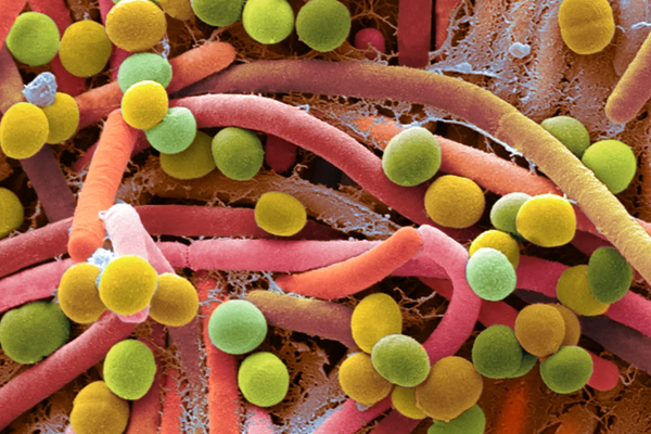 如何保持肠道健康？